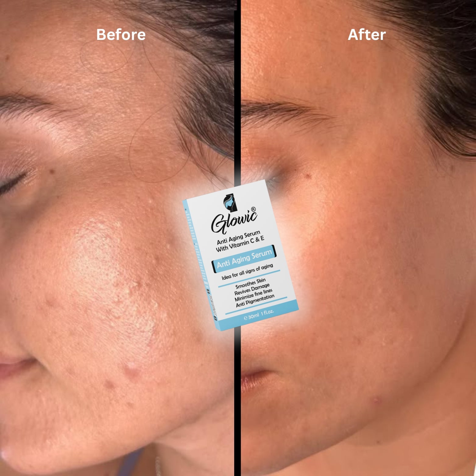 Before and after comparison of a face with Glowie serum packaging overlayed.