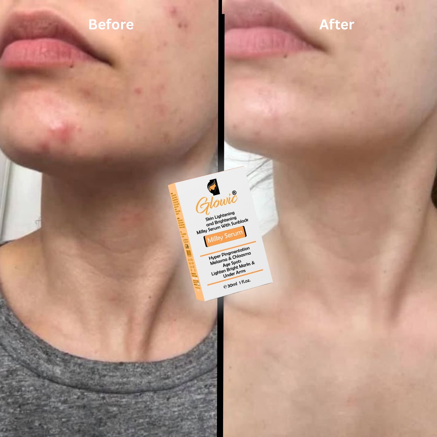 Glowic Lightening & Brightening Milky Serum 30ml