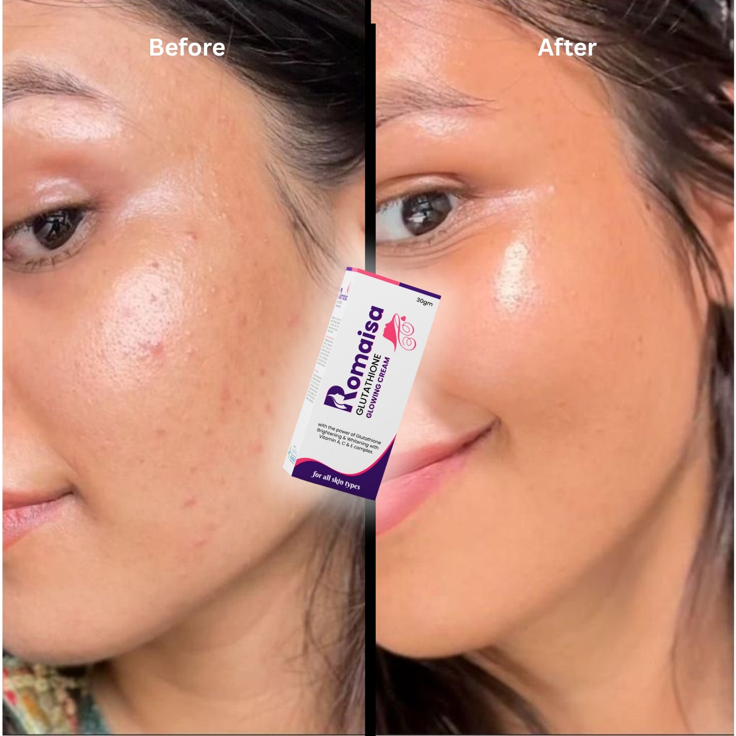 Romaisa Glutathione Glowing Cream – 30gm